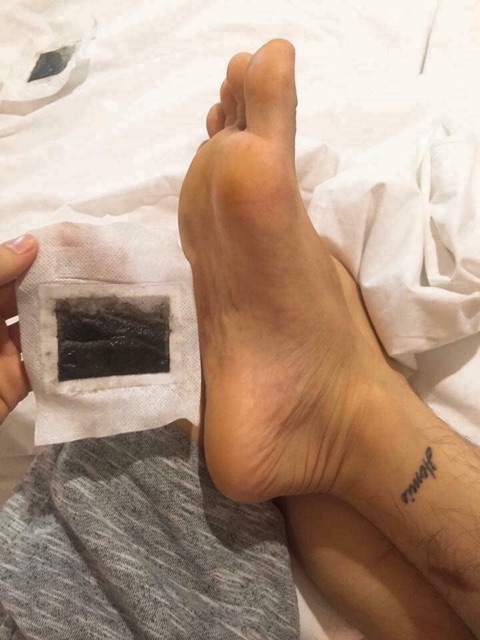 Miếng dán thải độc tố bàn chân Thailand | BigBuy360 - bigbuy360.vn