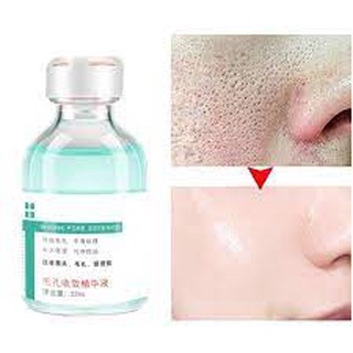 Serum zenshow hỗ trợ se khít lỗ chân lông to