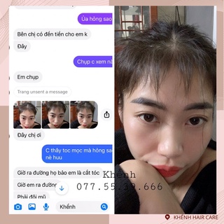 COMBO HỖ TRỢ MỌC TÓC, HỖ TRỢ GIẢM RỤNG