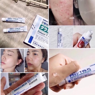 Gel bôi mụn viêm