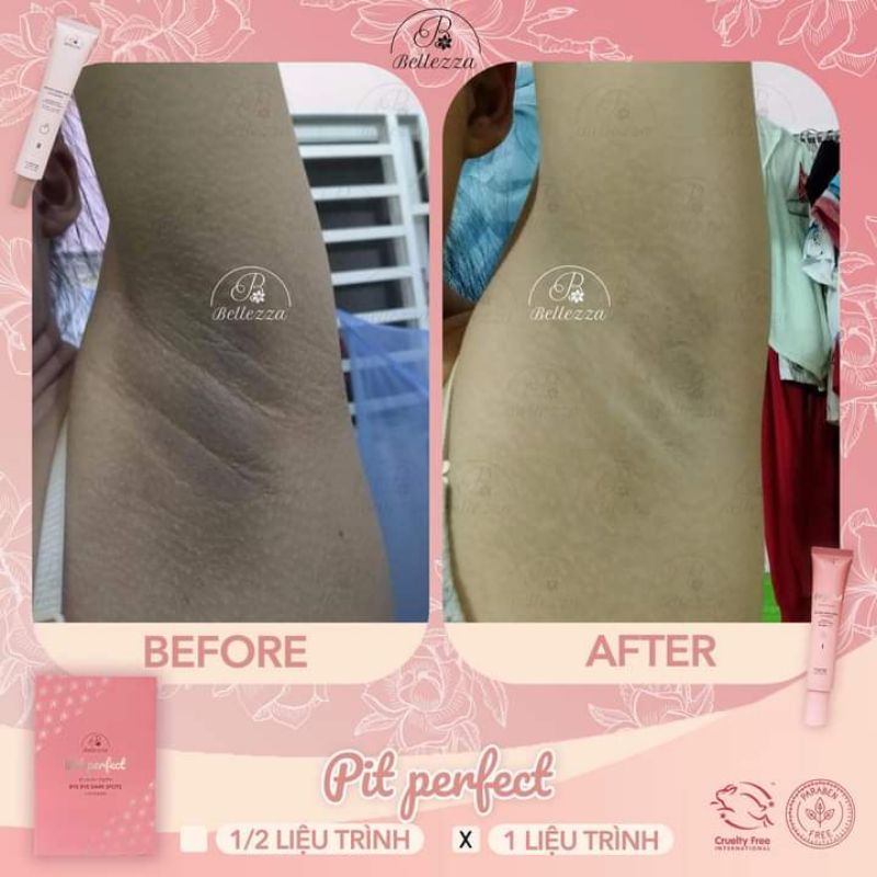 KEM KHỬ THÂM VÙNG NÁCH BẸN BELLEZZA