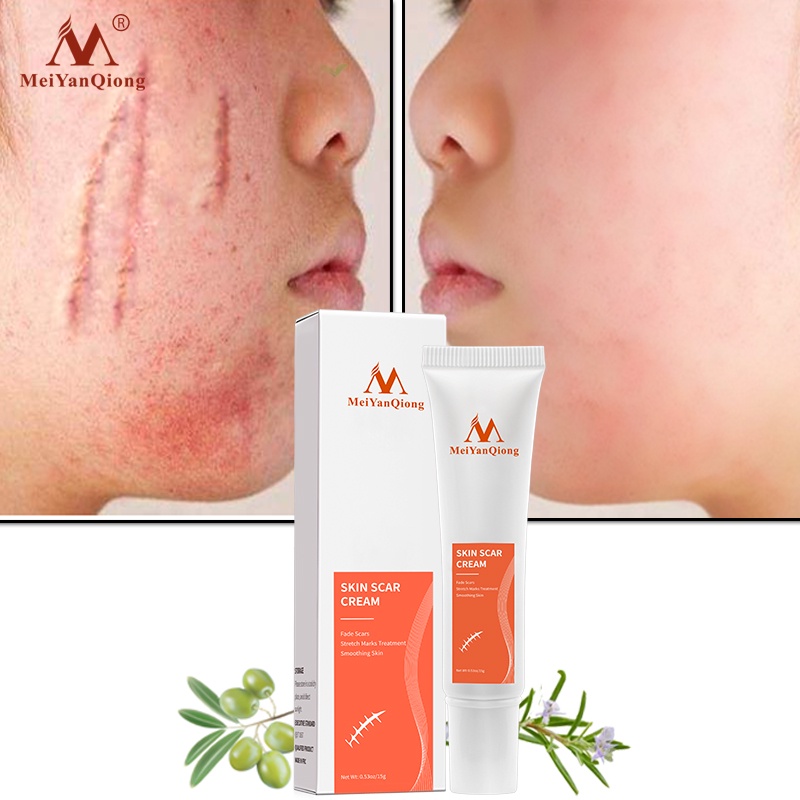 MeiYanQiong Acne Scar Removal Cream Skin Repair Stretch Marks giảm sẹo lồi, lõm, sẹo thâm, do mụn giúp phục hồi các tổn thương trên da thúc đẩy tái tạo da 15ml