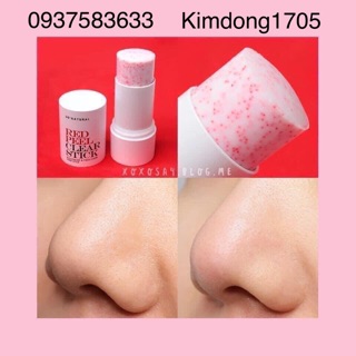 Lăn mụn đầu đen mụn cám- Red peel Clear Stick
