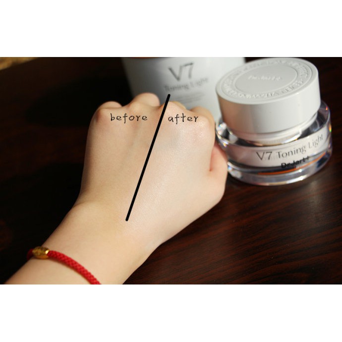 Kem dưỡng trắng da Freeship Kem face Dr.Jart+ V7 Toning Light 15ml, 50 ml, Tái Tạo Da, Giảm Thâm Mụn, Nám, tàn nhang