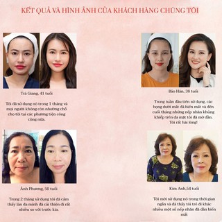 Kem chống lão hóa 22 Again