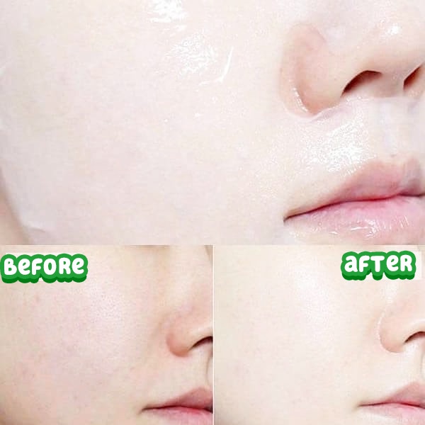 Mặt Nạ Tràm Trà Giảm Mụn SexyLook Tea Tree Anti Blemish Black Facial Mask