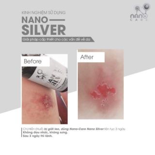 Nano bạc nguyên chất