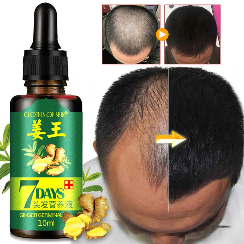 (Hàng Mới Về) Serum Kích Thích Mọc Tóc Và Chăm Sóc Sức Khỏe | BigBuy360 - bigbuy360.vn