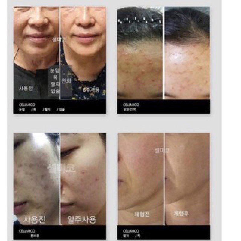 Tế Bào Gốc Cellmico Mẫu Mới Nhất