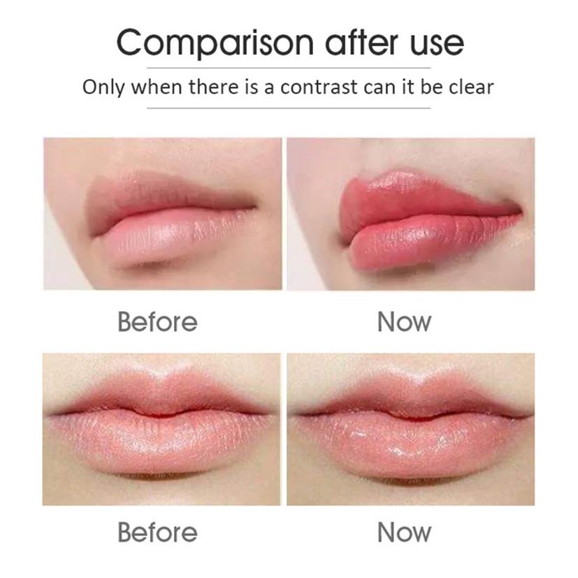 Son dưỡng môi có màu Vaselin Lip Therapy Rosy Lips 7g - Sáp dưỡng àm mềm môi, giảm thâm môi