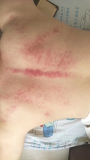 Tinh dầu massa thảo dược