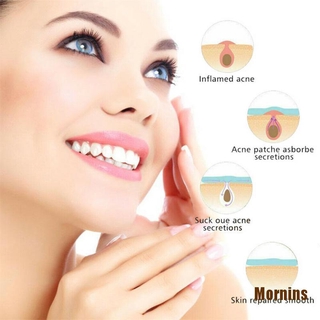 Ms❀Set 36 Miếng Dán Mụn Hydrocolloid Và Mụn Thịt Tiện Dụng