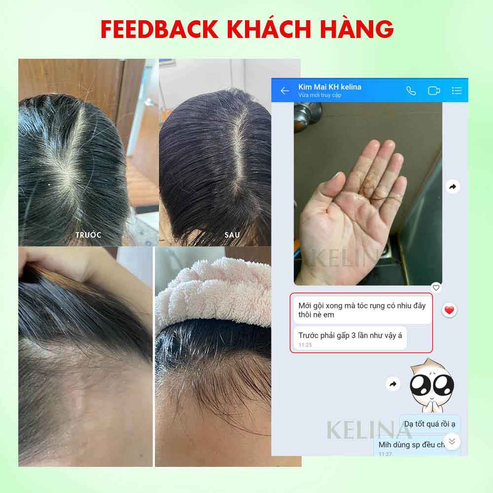 Combo Gội Xả Thảo Dược Kelina Kích Thích Mọc Tóc, Ngăn Gãy Rụng, Phục Hồi Hư Tổn Và Dưỡng Tóc Mềm Mượt 300ml