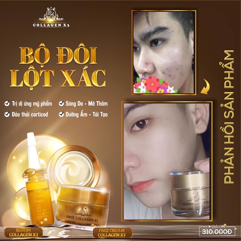 [Chính hãng] Combo Lột Xác Face + Serum Collagen X3 Mỹ Phẩm Đông Anh | BigBuy360 - bigbuy360.vn