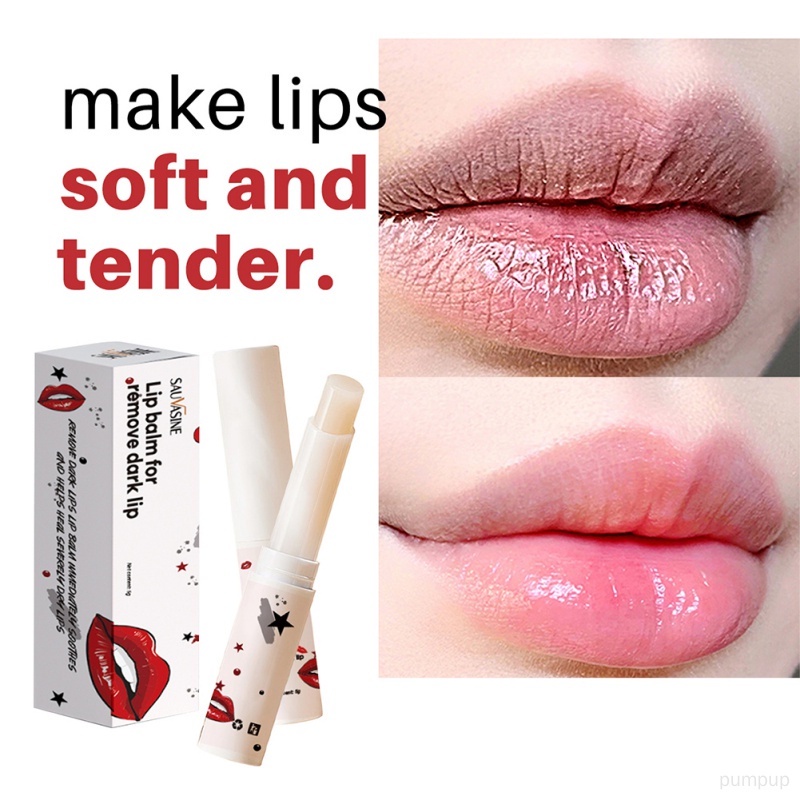Son Dưỡng Môi Giúp Dưỡng Ẩm Và Loại Bỏ Các Đốm Đen Trên Môi