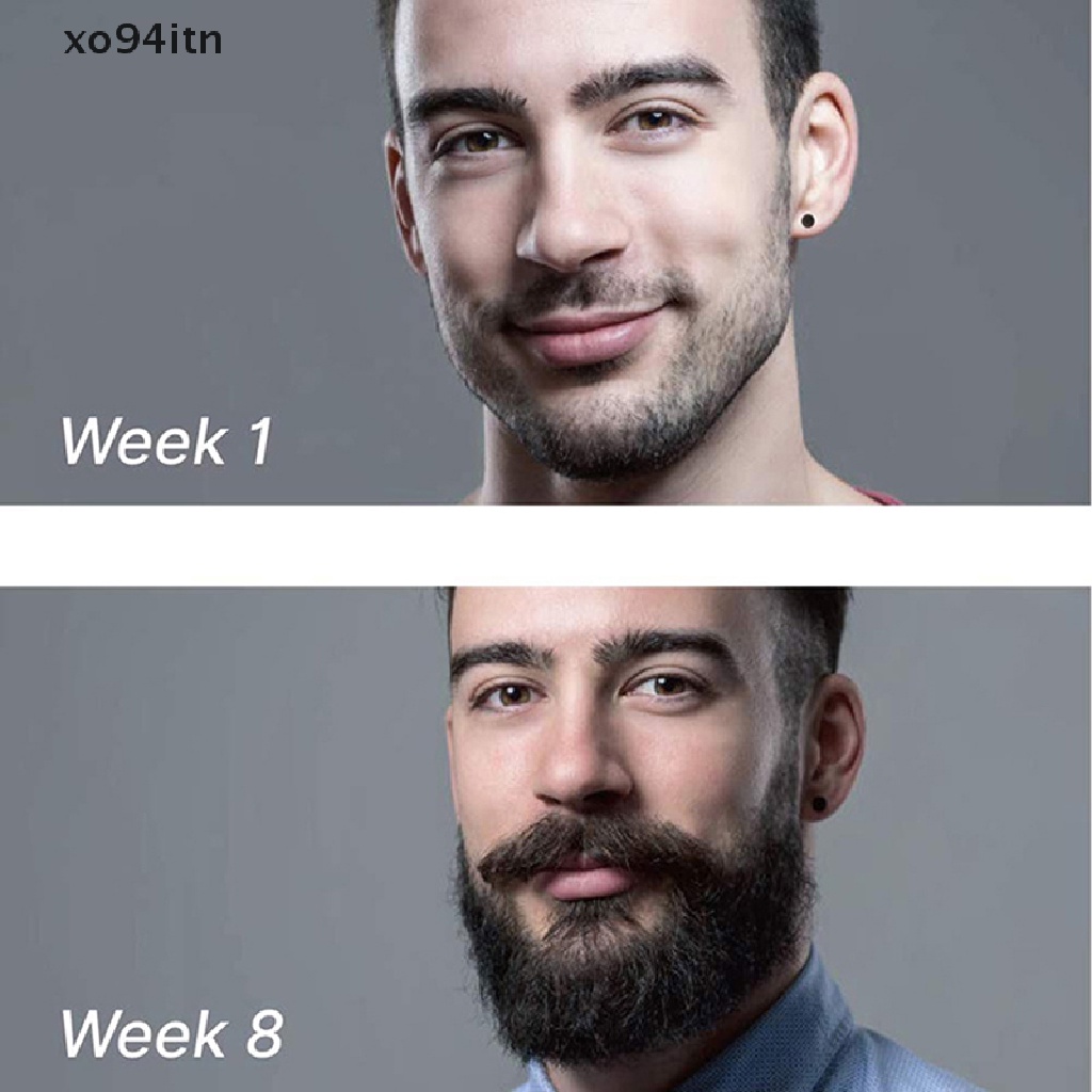 [Hàng mới về] Cây lăn mặt 540 kim siêu nhỏ chăm sóc kích thích mọc râu