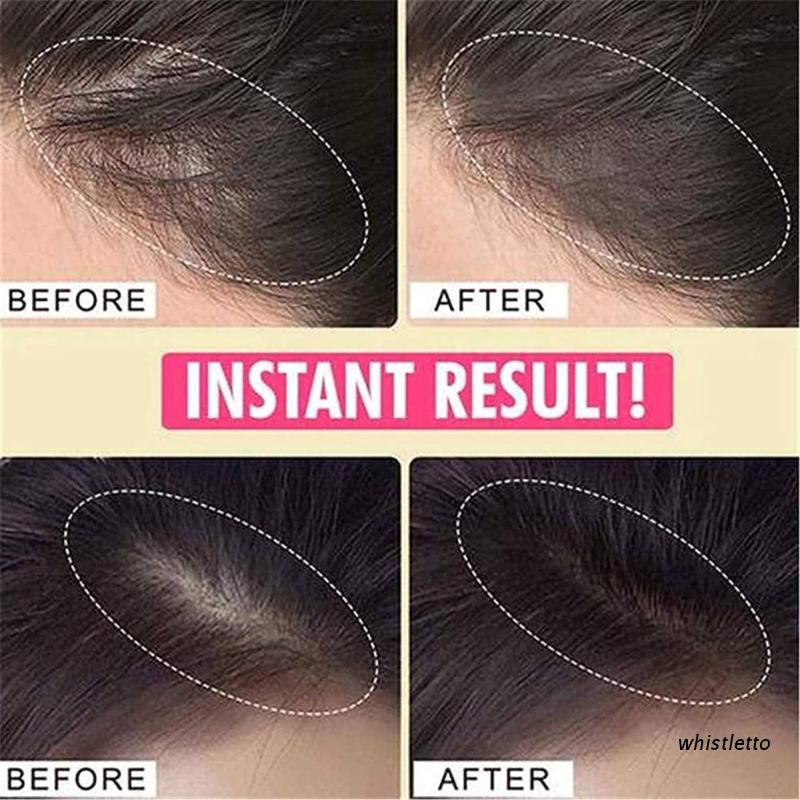 Bút Che Khuyết Điểm Chân Tóc Che Phủ Tóc Hói Nhanh Chóng