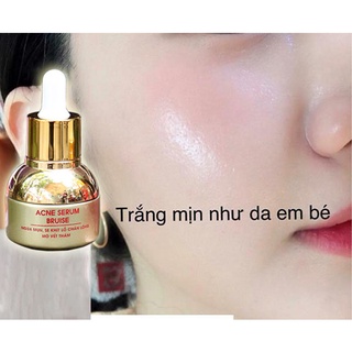 Serum Mụn Bio-Occi (25ml)