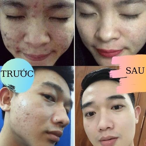 Bột rửa mặt thảo dược Đông y gia truyền thông cát _làm sạch da từ sâu bên trong, giúp căng bóng mịn màng