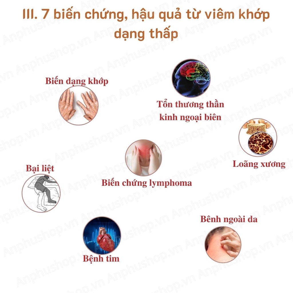 VIên uống xương khớp Noxa 20 Thái Lan ( Hộp 10 viên ) - Sản phẩm chính hãng