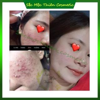 LINH CHI MỘC SẮC MỘC THIÊN