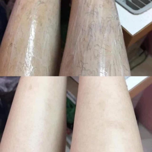 Kem triệt lông râu tận gốc vĩnh viễn thảo dược