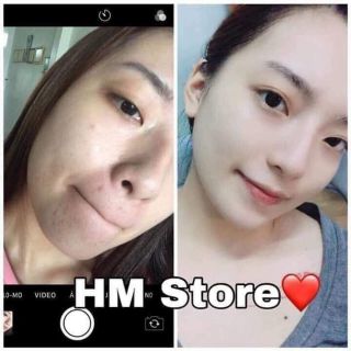 FACE TRẮNG HỒNG HM STORE