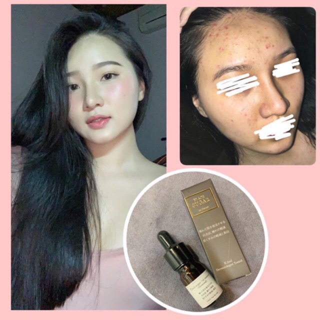 Serum đường đen Black sugar(khẳng định hiệu quả hơn mẫu caramel hồng nhé) KHÔNG HIỆU QUẢ HOÀN TIỀN