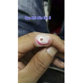 Miếng Dán Mụn Cóc ( Hiệu quả )