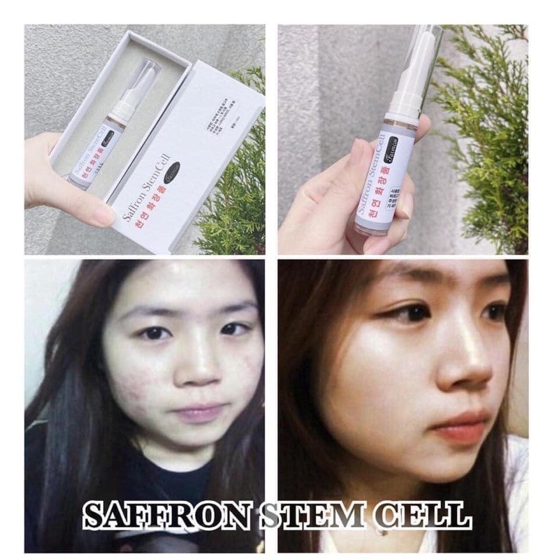 Saffron Tế Bào Gốc Hàn Quốc