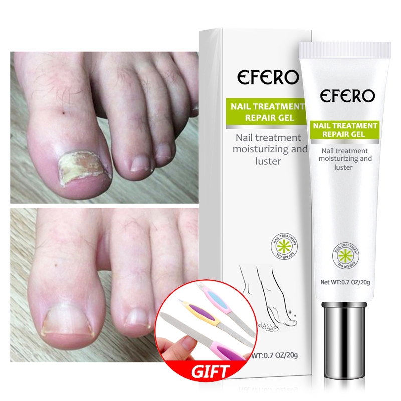 [Hàng mới về] Serum dưỡng loại bỏ nấm móng chân móng tay chống nhiễm trùng
