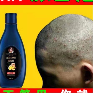Dầu gội hỗ trợ hết gầu, nấm da đầu hàng nội địa trung