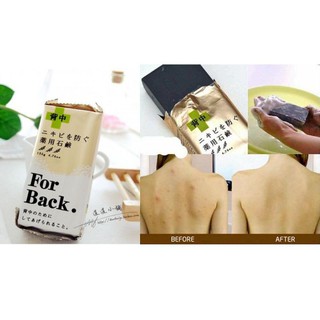Combo 2 xà phòng giảm mụn lưng for back