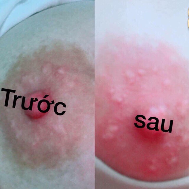 Ủ dưỡng hồng môi nhũ hoa Gong Ju Lip Scrub Aha | BigBuy360 - bigbuy360.vn