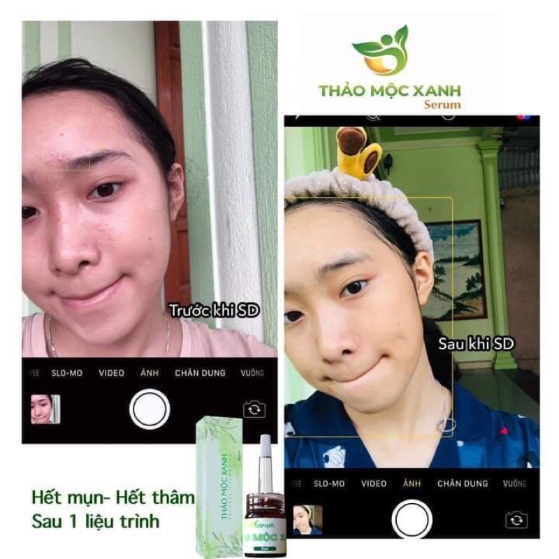 Thảo mộc xanh🔥 freeship 🔥 | BigBuy360 - bigbuy360.vn