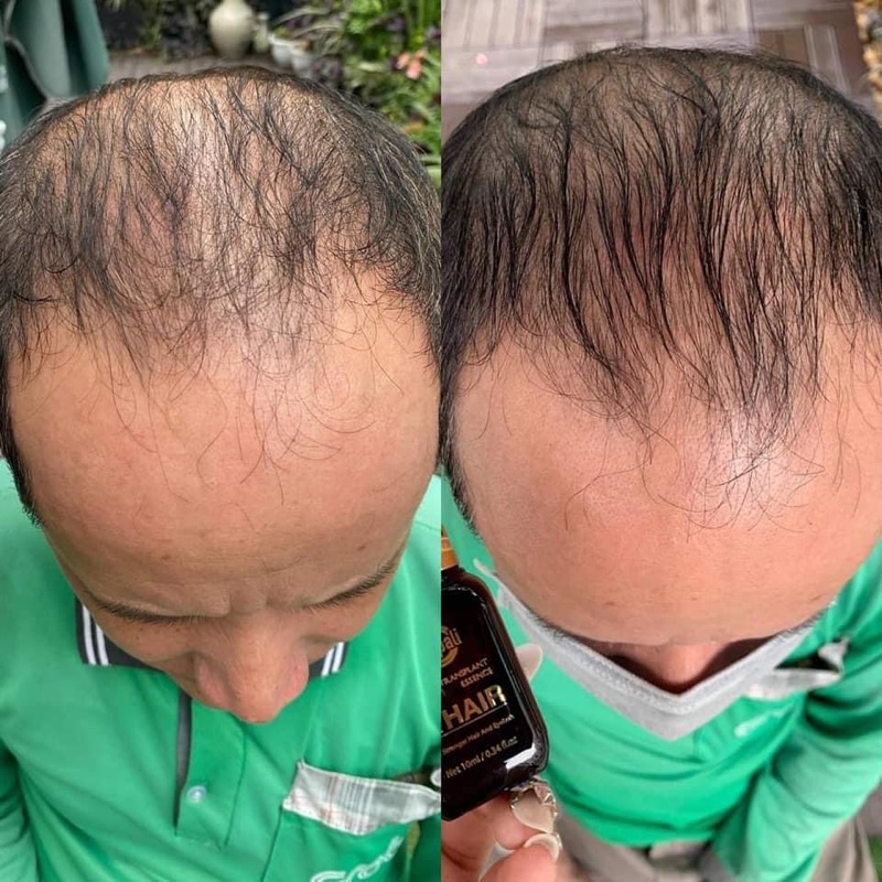 Dr.Hair [CHÍNH HÃNG] kích thích mọc tóc và mi