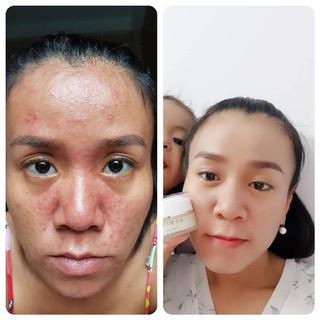 Kem thải độc Jewel Hàn quốc
