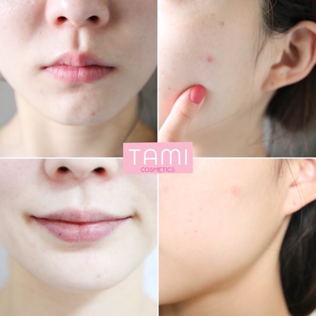 TINH DẦU TRÀ SOME BY MI 30 DAYS MIRACLE TEA TREE CLEAR SPOT OIL | BigBuy360 - bigbuy360.vn