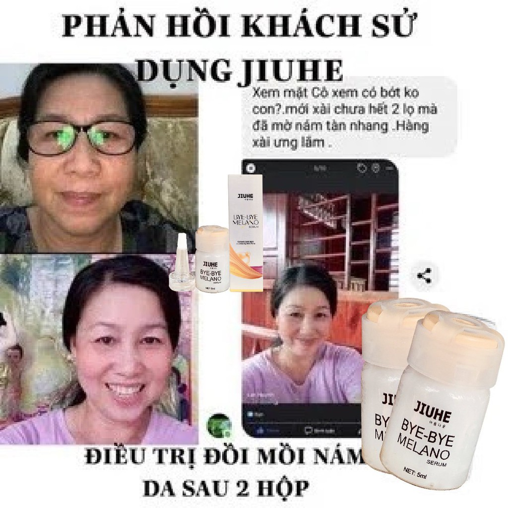 Serum tri thâm hàn quốc JIUHE Q-PEARL giảm thâm do mụn khửu tay chân, thâm sẹo, thâm nách hiệu quả | BigBuy360 - bigbuy360.vn