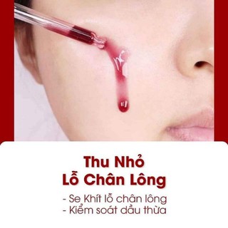 Serum Tái Tạo Da Red Peel Tingle