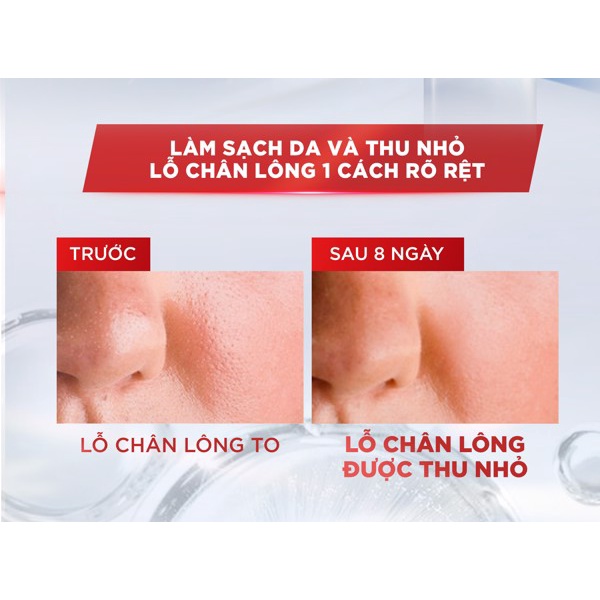 Nước Tẩy Trang Đa Năng 3-in-1 L'Oreal Paris Revitalift Crystal Purifying Micellar Kiềm Dầu Cho Làn Da Sáng Mịn 400ml