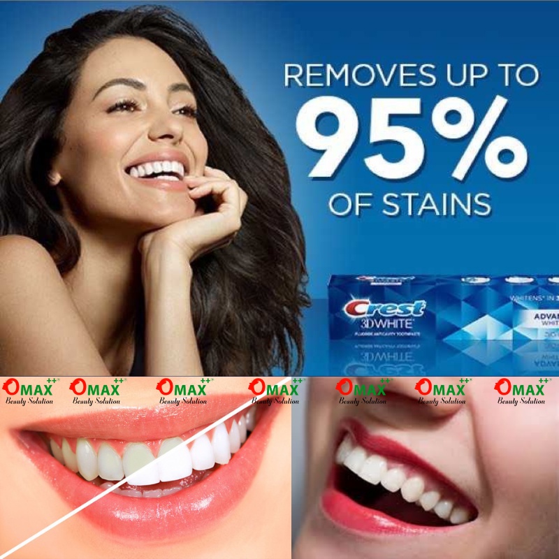 KEM ĐÁNH RĂNG CREST MỸ 158G - RĂNG CHẮC KHỎE - TRẮNG SÁNG - GIẢM NƯỚU VÀ HÔI MIỆNG