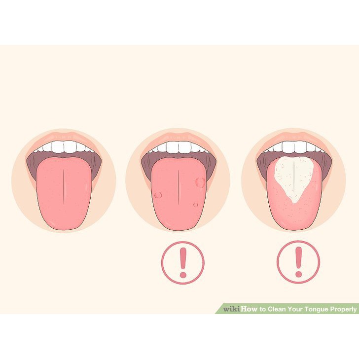 COMBO 5 CÂY Dụng Cụ Cạo Lưỡi Làm Sạch Lưỡi Bằng Nhựa - Thìa Cạo Vệ Sinh Răng Miệng Mảng Bám - Cây Nạo Lưỡi Làm Sạch Lưỡi