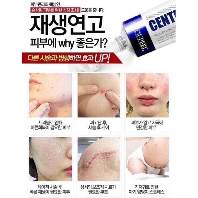 Kem Rau Má giảm mụn,cải thiện phục hồi Da MediPeel Centella Mezzo Cream