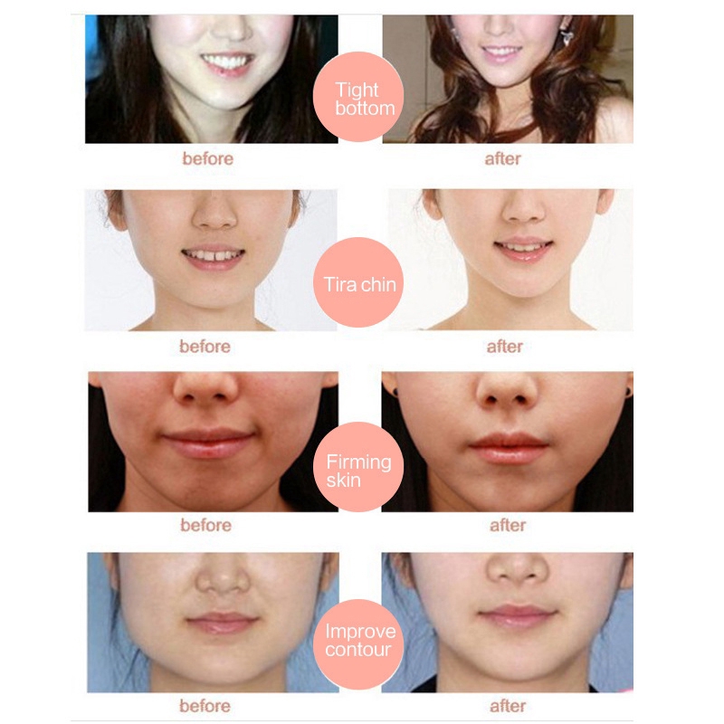 [Hàng mới về] Mặt nạ thon gọn mặt tạo cằm chữ V 3D cho nữ