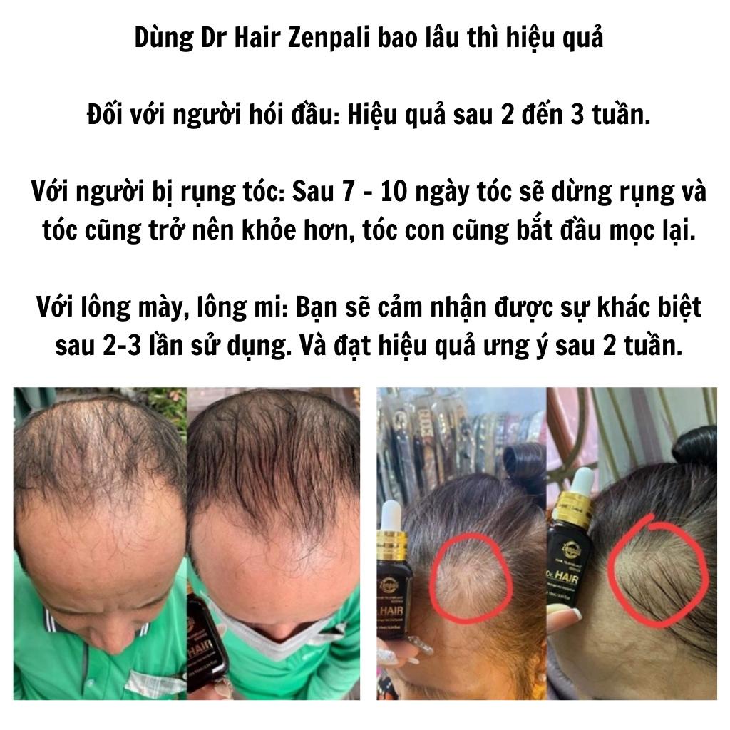 Dr hair zenpali chính hãng kích thích mọc tóc nhanh dưỡng mi dài lông mày dày tinh chất serum chống rụng tóc AME