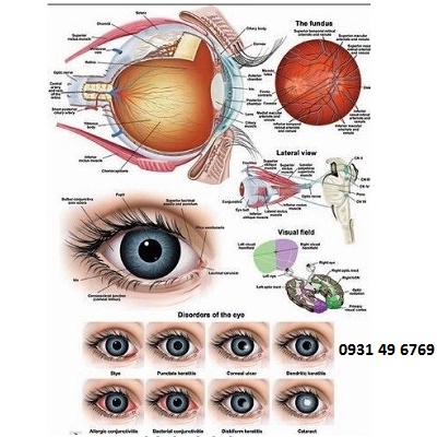 Tranh giải phẫu mắt (Disorders of the Eyes)