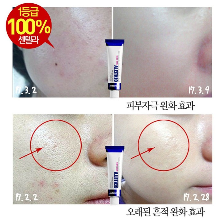 Kem dưỡng Medi-Peel Centella Mezzo Cream 30ml giúp giảm mụn, phục hồi da, làm dịu da.