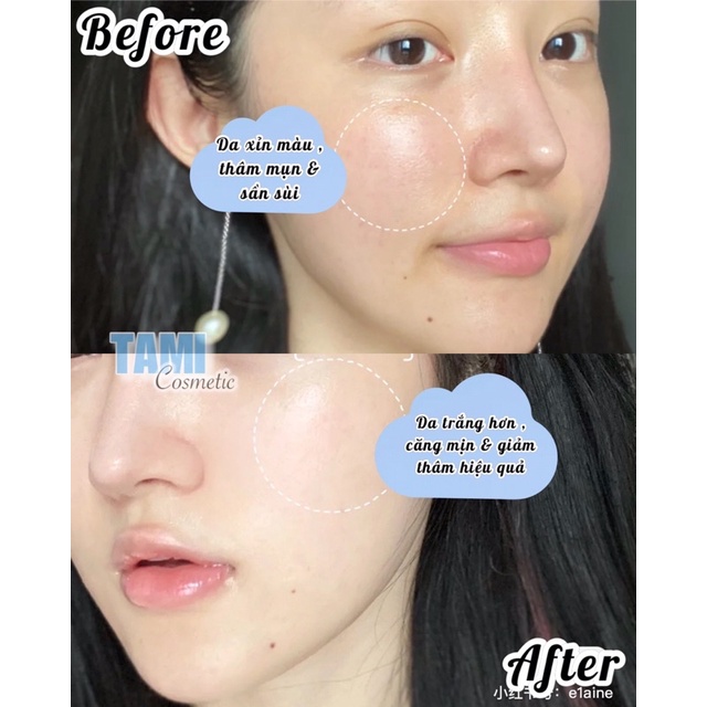 Tinh Chất Smas Pro Vitamin B5 / HA Plus