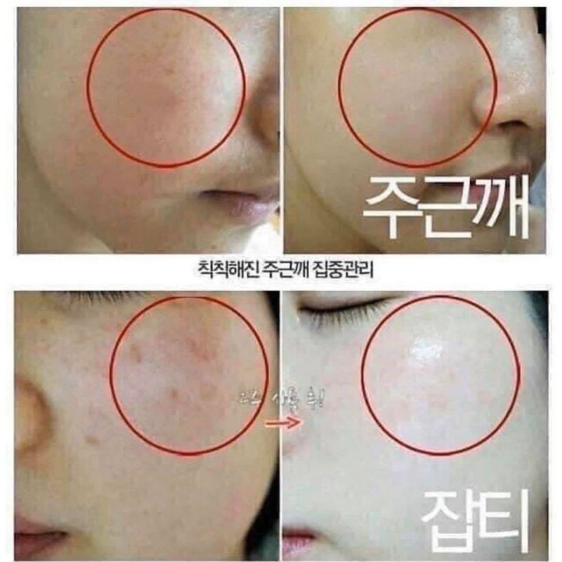 SERUM VITAMIN C NGUYÊN CHẤT KAKADU aboutme làm trắng giảm thâm nám